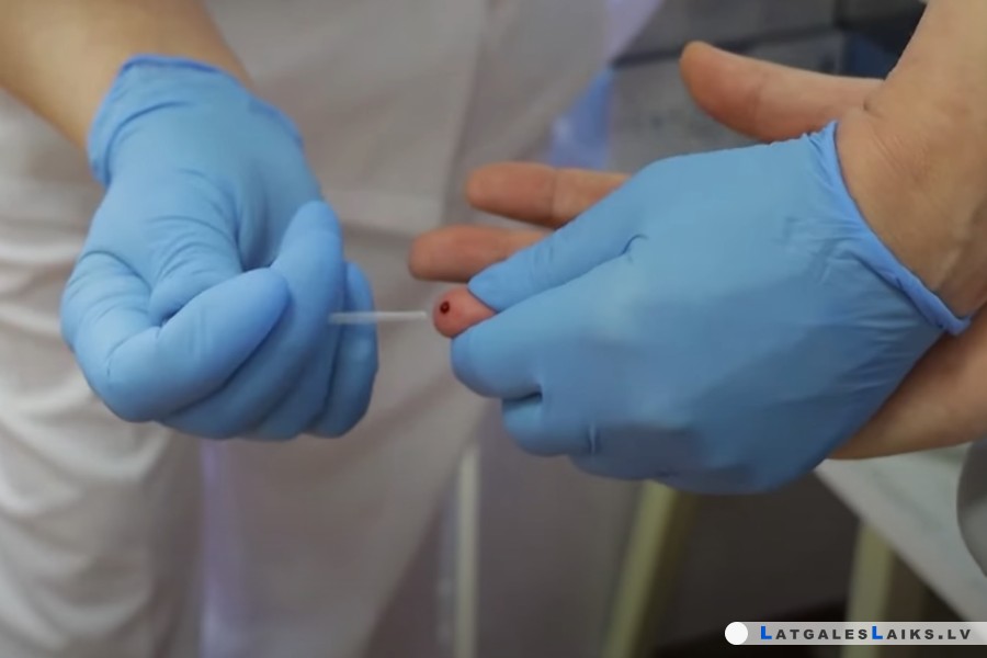 Latgalē — lielākais saslimušo skaits ar C hepatītu
